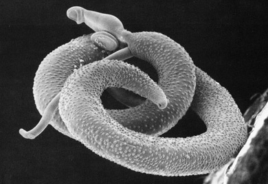 Name:  casiraghi_schistosoma.jpg
Views: 119
Size:  37,7 KB